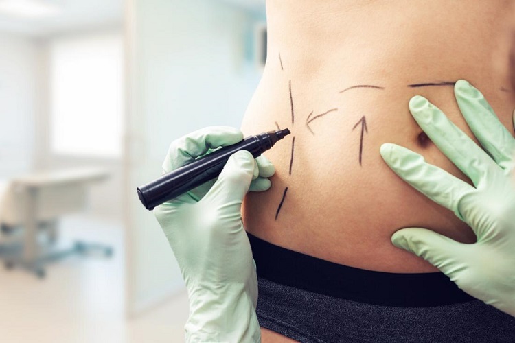 Cosmetic Surgery