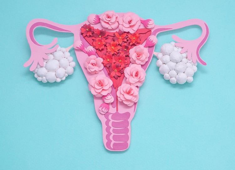 PCOS